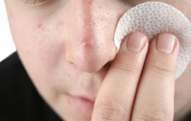 Boy pressing a pad against zit on his face